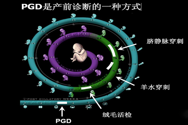 什么是胚胎植入前基因检测？试管婴儿移植前基因检测