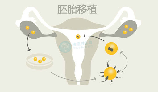 胚胎移植_副本.jpg