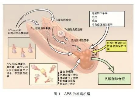 做试管婴儿前是否有必要检查自身免疫抗体?自身免疫抗体对妊娠结局的影响及分析