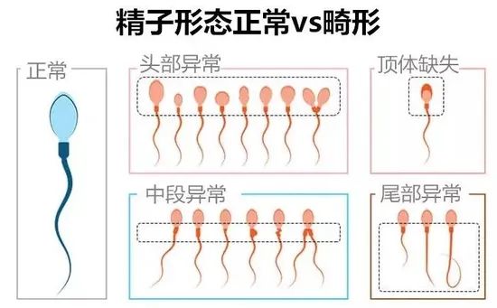 试管婴儿想要胚胎健康发育，精子质量不能忽视！