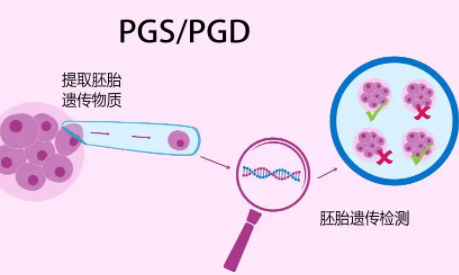 男性最佳生育年龄是多少？高龄男性该如何备孕? 高龄男性试管婴儿助孕