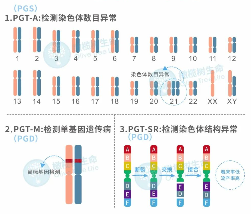 什么是羊水穿刺产前诊断?为什么要做羊水穿刺产前诊断？试管婴儿的最后一道“安检”-羊水穿刺！