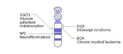 染色体22
