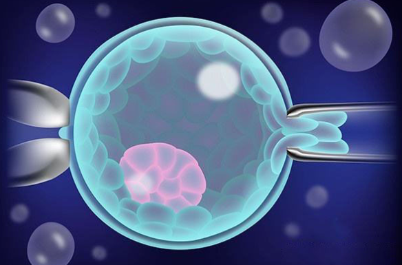 什么是卵巢过度刺激综合征?卵巢过度刺激综合征怎么治疗？卵巢过度刺激综合征对试管婴儿有什么影响？