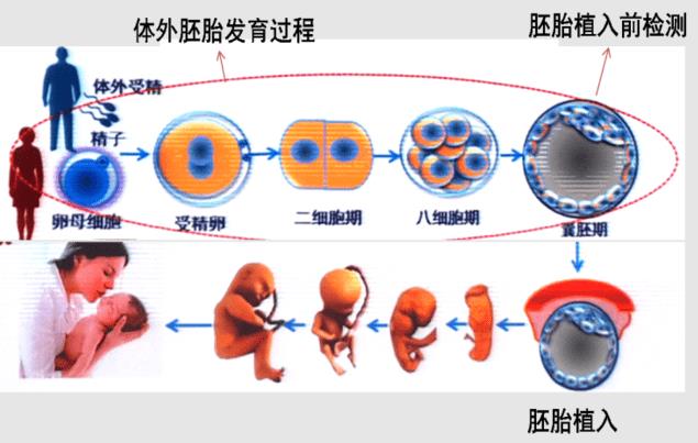 试管婴儿出生的孩子比自然出生的孩子差吗？试管婴儿出生的孩子和自然出生的孩子之间的区别是什么？