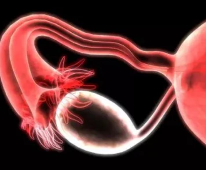 输卵管积水的症状是什么？输卵管积水会影响女性受孕吗？输卵管积水可以做试管婴儿吗？