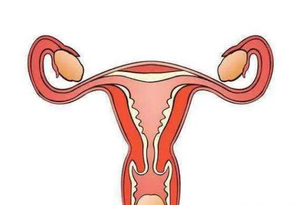 子宫异位症有哪些症状？子宫异位症还能做试管婴儿吗？子宫内膜异位症可怕吗？