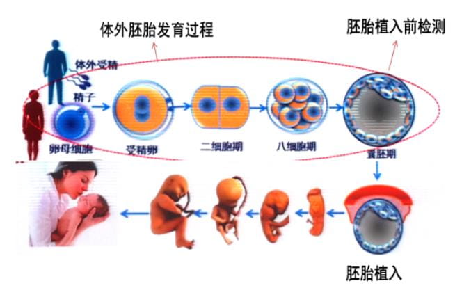 什么是杜氏肌营养不良？杜氏肌营养不良临床诊断方法，试管婴儿助力生育健康宝宝！