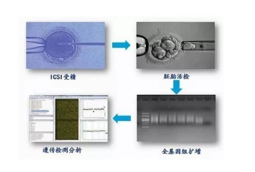 久备不孕真愁人，也许被弄丢的那条祖传染色体才是“真凶”！