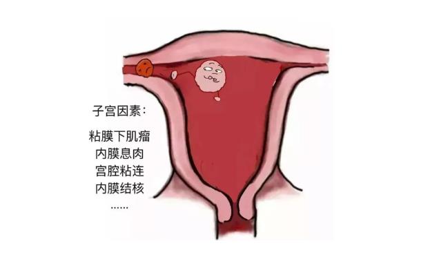 为什么做试管也会出现生化妊娠？为什么试管婴儿也会生化妊娠？如何避免生化妊娠？