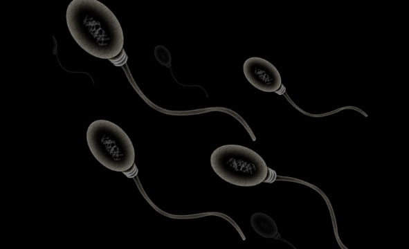 精子畸形率高，还能怀孕吗？精子畸形率高，怎么治疗？