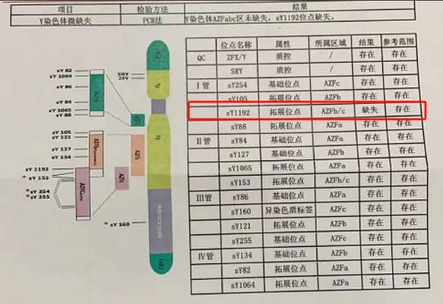 不是空穴来风！生育前必须要了解这项检查！