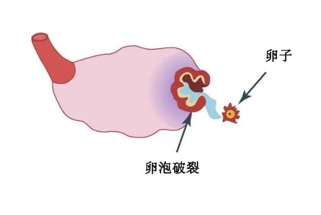 这三类人群，可以考虑一个促排周期取两次卵！