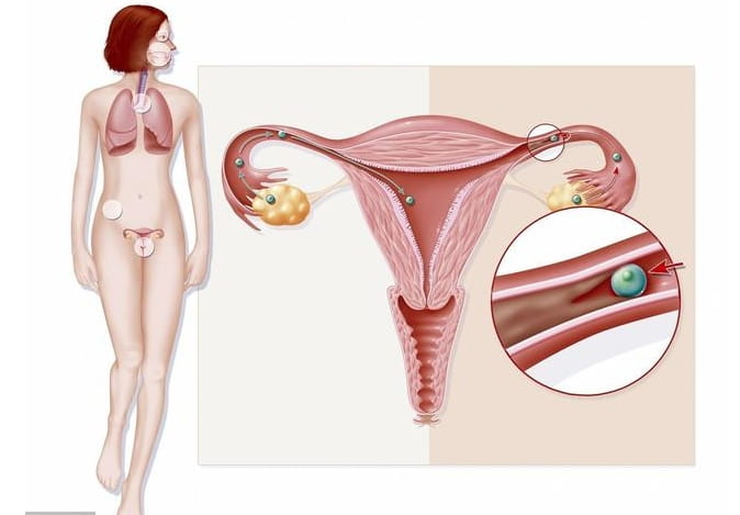 先天性卵巢发育不良可以做试管婴儿吗？先天性卵巢发育不良女性怀孕后的问题？