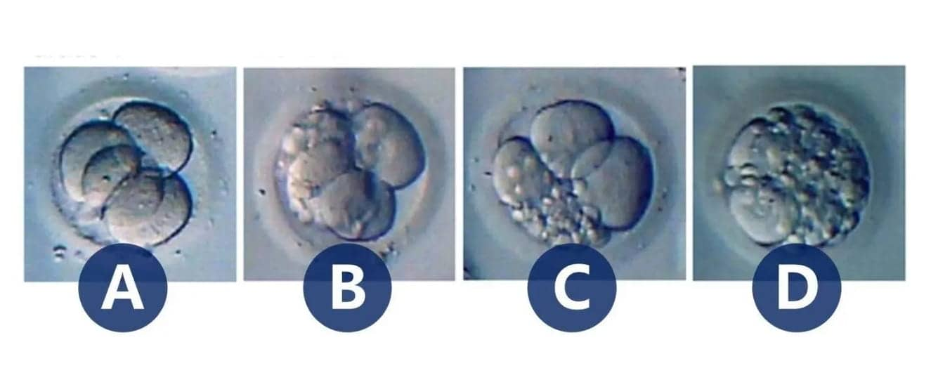 试管婴儿胚胎质量如何划分？囊胚移植和普遍胚胎移植有什么区别?囊胚移植和普遍胚胎移植有什么区别?