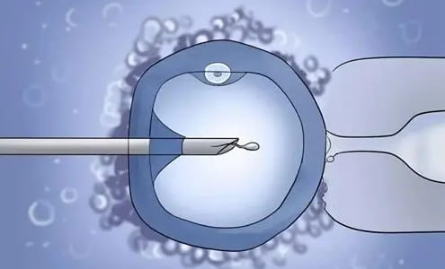 试管技术对宝宝健康的影响？试管婴儿出生缺陷率更高吗？试管婴儿是否会导致卵巢早衰？