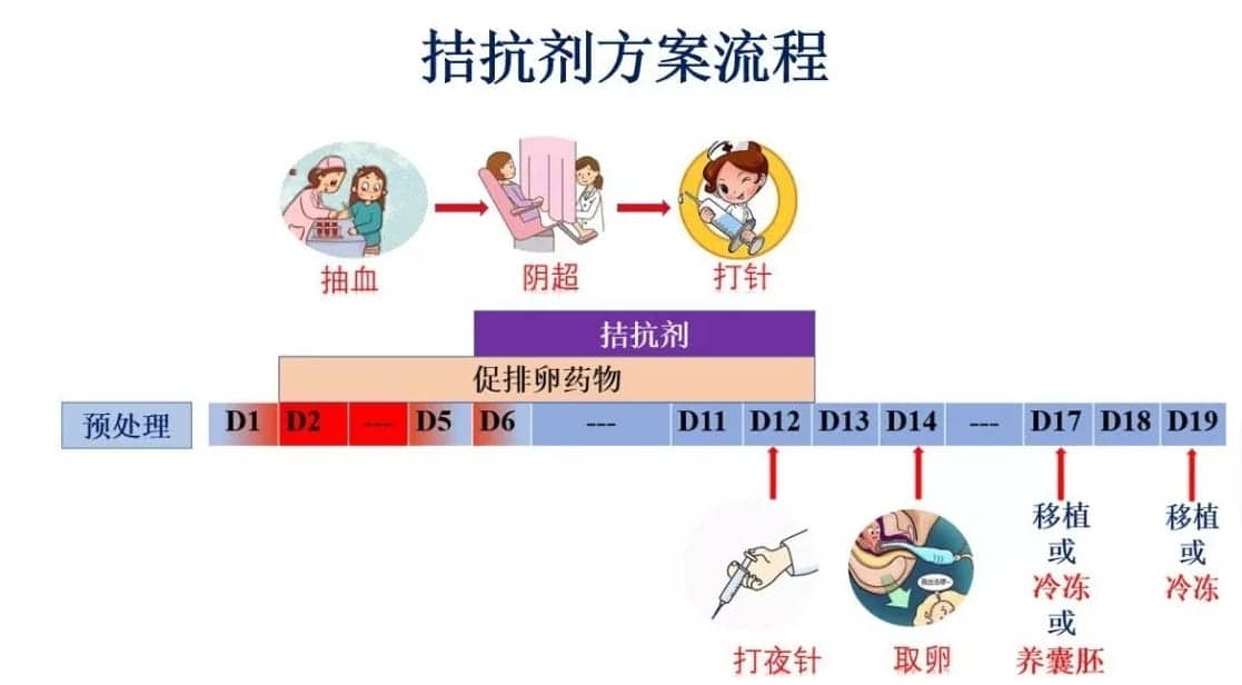 试管婴儿促排卵有几种方案？试管婴儿促排卵方案都有哪些特点？试管促排卵方案这么多你适合哪种呢？