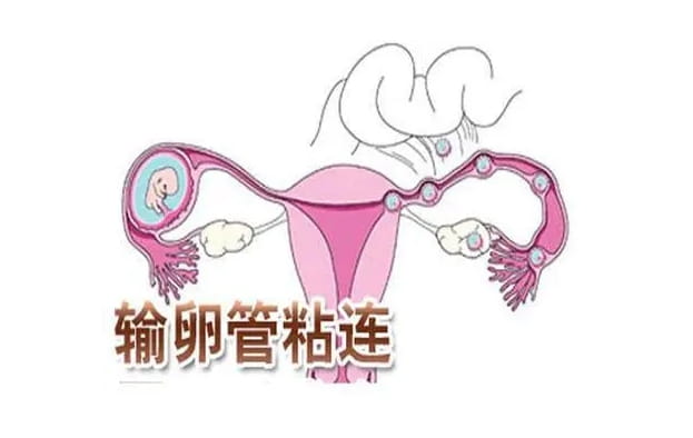 输卵管堵塞也会导致怀孕难？输卵管的检查方法有哪些？三种检查方法中那个是最最多和最常用的？
