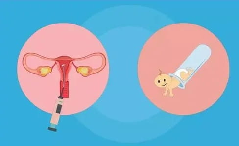 试管移植前为什么要进行子宫内膜诊刮？做试管婴儿的都要刮宫吗？试管婴儿前期的准备工作是什么？