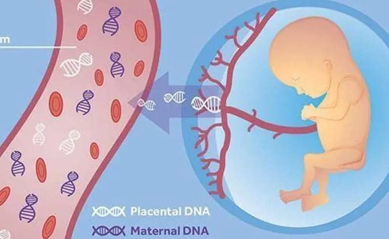助孕妈必看无创dna131项检查清单有哪些项目？是否有必要花大价钱做131项检查呢？