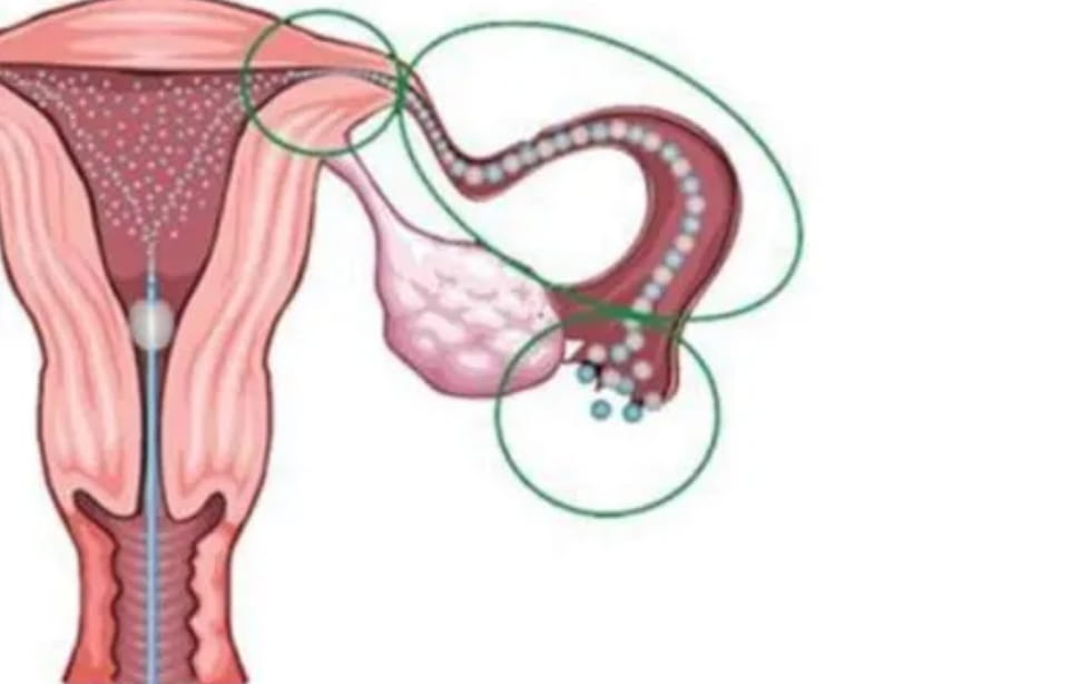 一起来了解卵巢早衰的定义，卵巢有哪两种功能？卵巢早衰的危害有哪些？