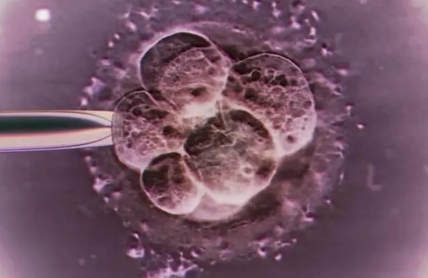 2号染色体部分缺失的严重性？染色体异常会影响胎儿发育，2号染色体杂核缺失的影响有哪些？