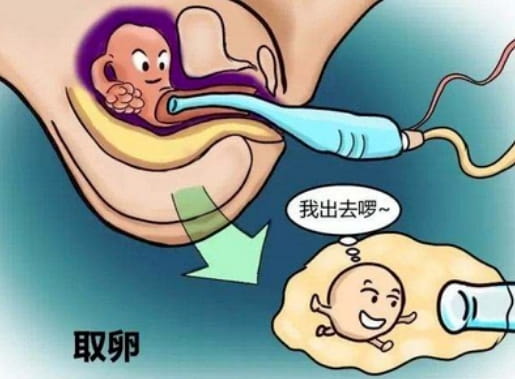 试管婴儿的卵手术该怎么做？绵阳市中心医院做试管婴儿取卵手术有多疼？