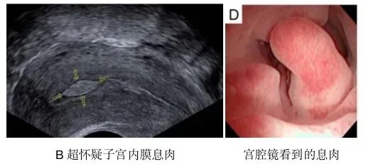 宫腔镜手术会影响怀孕吗？哪些宫腔疾病需要做宫腔镜手术？宫腔镜术前和术后注意事项有哪些？