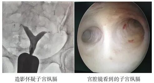 宫腔镜手术会影响怀孕吗？哪些宫腔疾病需要做宫腔镜手术？宫腔镜术前和术后注意事项有哪些？