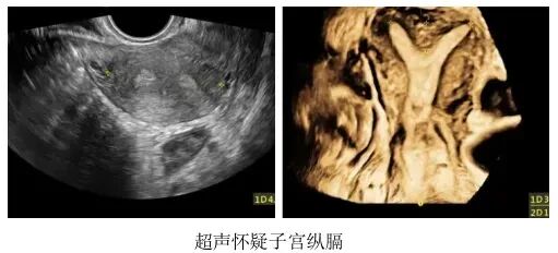 宫腔镜手术会影响怀孕吗？哪些宫腔疾病需要做宫腔镜手术？宫腔镜术前和术后注意事项有哪些？
