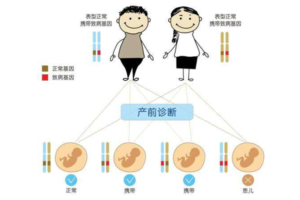 做试管婴儿前为什么要检查染色体？