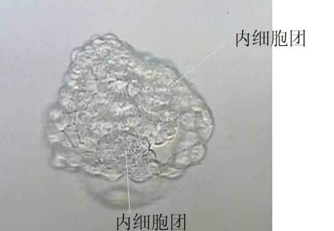 试管移植囊胚会有生双胞胎的可能吗？移植一个囊胚生双胞胎的几率如何？