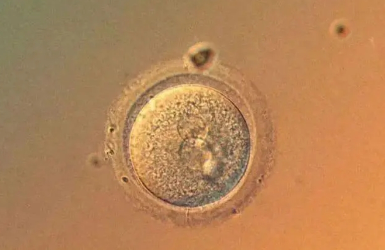 什么是空卵泡？造成空卵泡的原因又是什么呢？试管婴儿促排卵为什么会有空卵泡的情况发生？