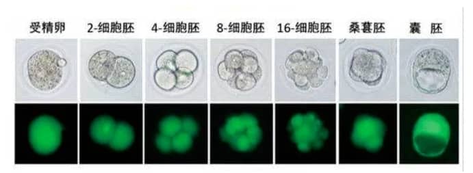 高龄女性试管婴儿失败的主要因素是什么？如何改善高龄女性生殖衰老及卵子质量下降?