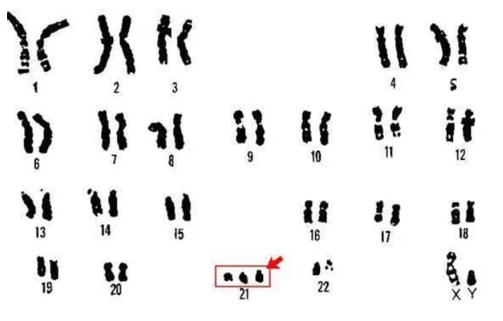 什么是囊胚培养？试管婴儿胚胎培养成囊胚就一定能移植成功吗?