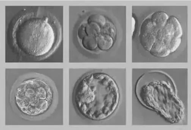 什么是囊胚培养？试管婴儿胚胎培养成囊胚就一定能移植成功吗?