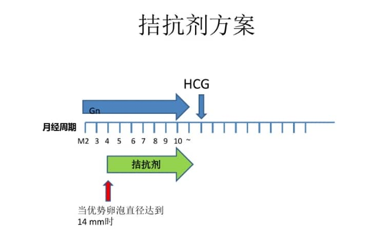 试管婴儿促排卵方案有哪些？如何选择合适的试管婴儿促排卵方案？临床常用的试管婴儿促排卵方案及适用人群概述