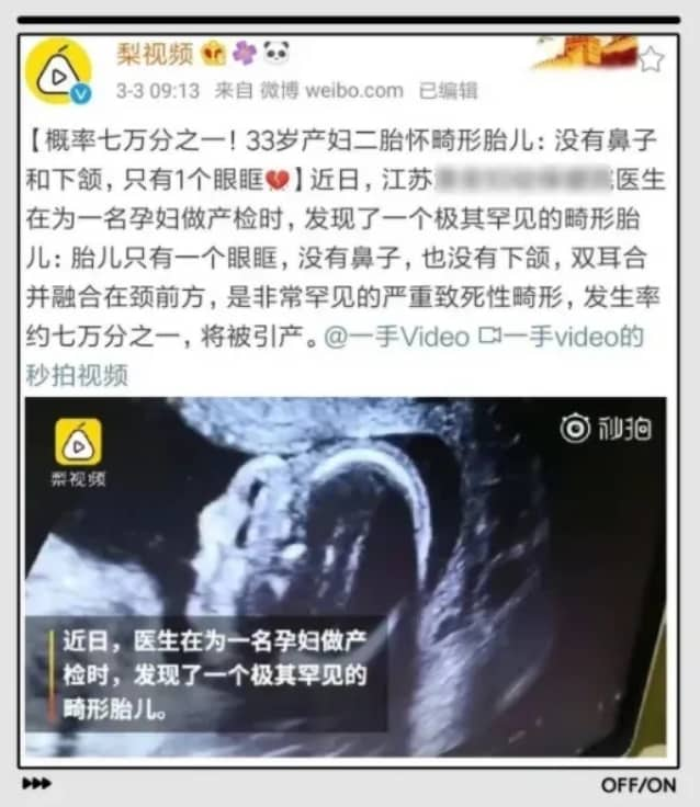 孕前需要做哪些检查？孕期有哪些注意事项？产后新生儿应该做哪些筛查？