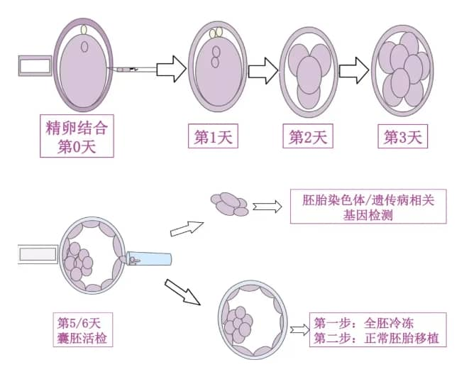 世界地贫日丨地贫虽难治，但胜在可预防！选择三代试管婴儿技术生育健康宝宝