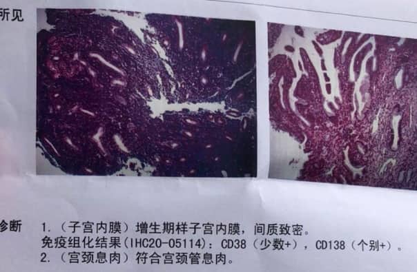 试管婴儿中慢性子宫内膜炎的诊断方法有哪些？慢性子宫内膜炎如何影响试管婴儿的成功率？