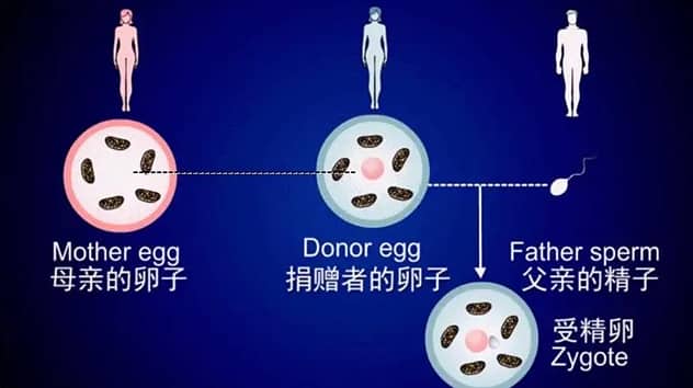 第四代试管婴儿技术的具体操作流程是什么？第四代试管婴儿技术适用于哪些人群？