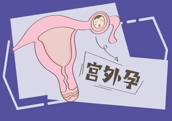 试管婴儿妊娠早期出血的原因是什么？试管婴儿妊娠早期出血是不是流产了？