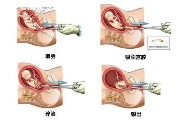 什么是不孕不育？不孕不育的现实原因有哪些？为什么身边患有不孕不育的人越来越多？