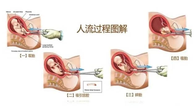卵巢对女性有多重要？卵巢功能衰退会出现哪些问题？卵巢功能衰退的影响试管婴儿成功率吗？