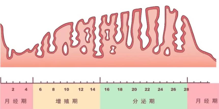 子宫内膜厚度23mm正常吗？试管婴儿期间子宫内膜厚度为多少？