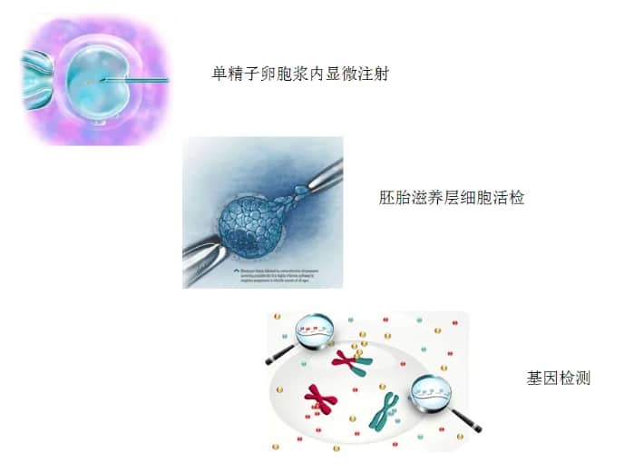 试管婴儿技术能否避免遗传病的发生？遗传咨询在试管婴儿过程中起到什么作用？