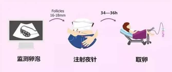 做试管婴儿什么样的卵泡才能被取？试管婴儿中B超显示的多卵泡数量与实际取到的卵子数量为什么不一致？