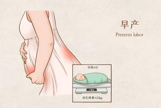试管婴儿技术是否适合高龄人群进行单胚胎移植？高龄女性在进行试管婴儿时应该注意哪些并发症风险？