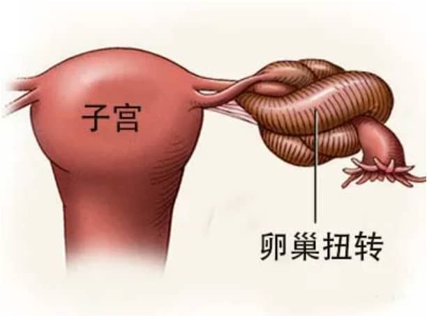 试管婴儿移植后出现腹痛是正常现象吗？如何缓解试管婴儿移植后的心理压力以助于妊娠成功？