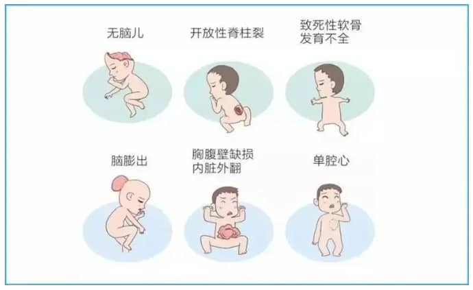 哪些因素会导致胎儿畸形? 胎儿发育不良会有哪些症状? 备孕人群请注意，这四大因素可致胎儿畸形！